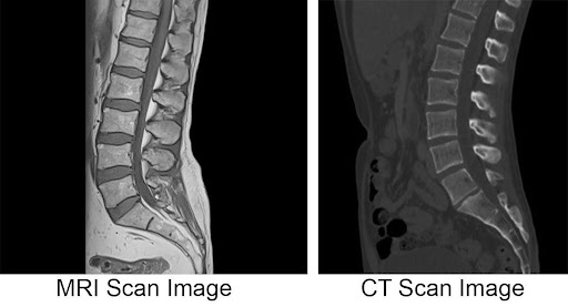 CT_MRI_Side_By_Side_Casey